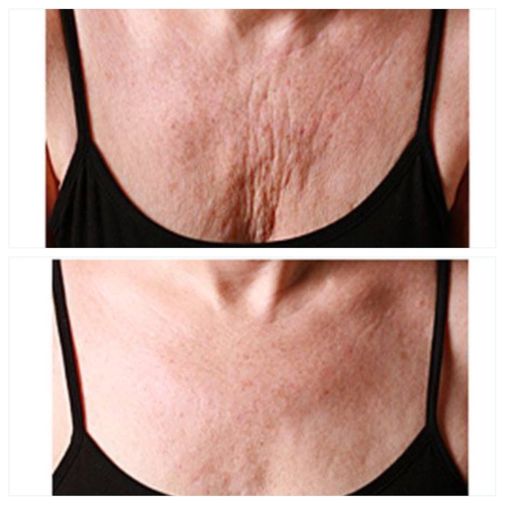 Wrinkle Recovery Chest Pad - The Edit LLC