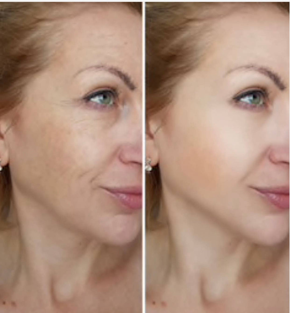 Wrinkle Recovery Eye Pad Set –Anti - Aging Skin Care - The Edit LLC